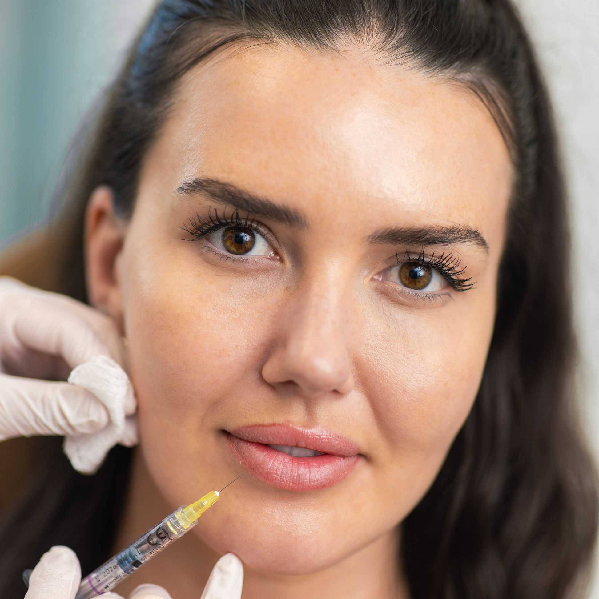 Dermal Filler