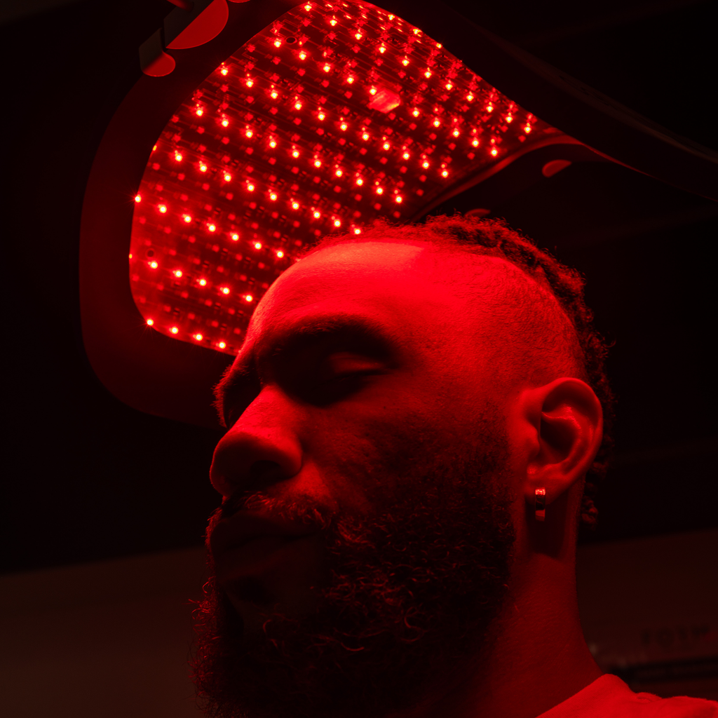 FUE Hair Transplant